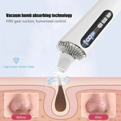 PorePerfect Electric Blackhead Vacuum - strohmly.com